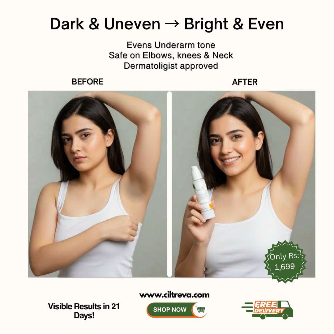 Under Arm Whitening Cream - Lighten Dark Patches Instantly - 50ml